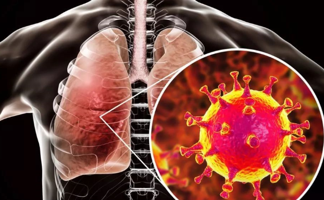 冠型病毒最新诮息,冠型病毒最新消息，全球抗击疫情的最新进展与洞察