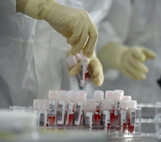 最新新冠病毒核酸检测解读与科普,了解检测背后的真相