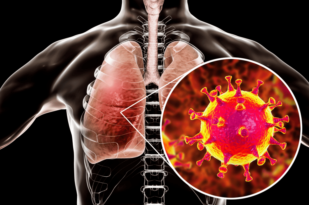 心型肺炎疫情实时更新,最新动态与防控进展