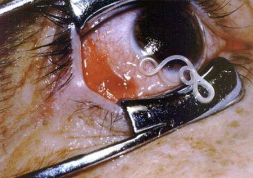 最新寄生虫病高科技产品介绍及概述