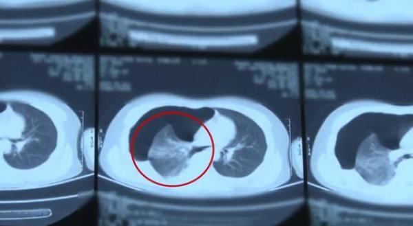 小明的友情之旅与最新医师资格的成长之路