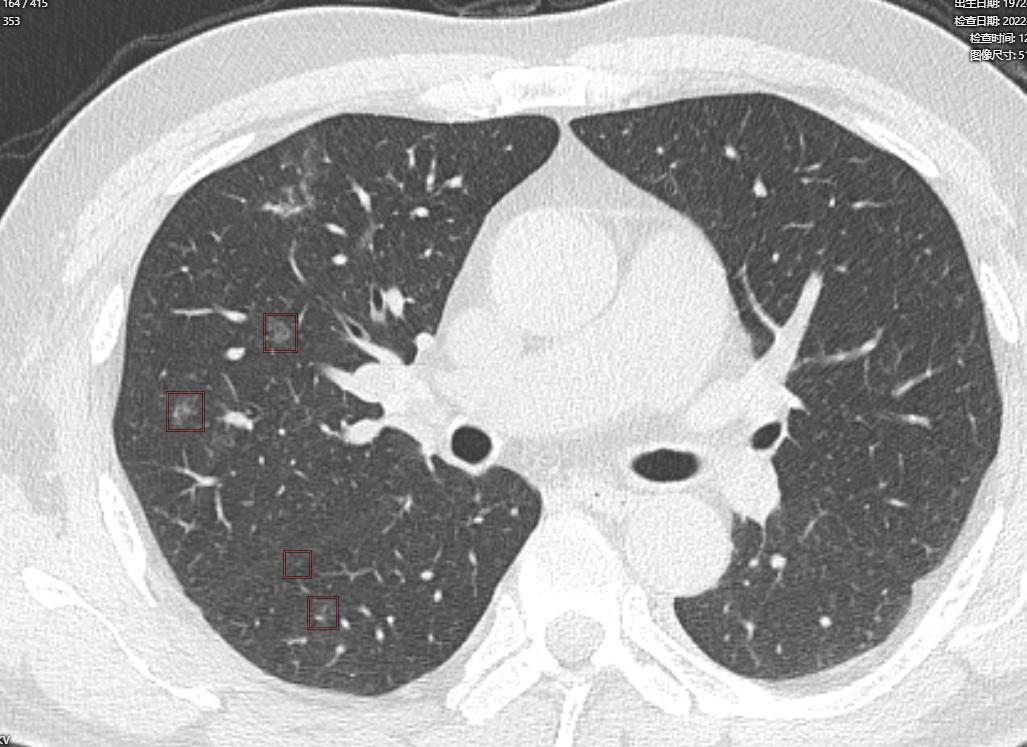 阜阳新冠病毒最新通告,变化带来自信,学习铸就未来之路