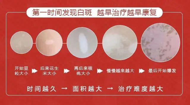 牛皮癣最新动态,走出困境,学习重塑自信与成就感之路