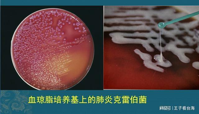 全球新冠肺炎最新实况下的温馨日常观察与记录