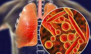 心冠病毒九月最新疫情,时代背景下的严峻挑战