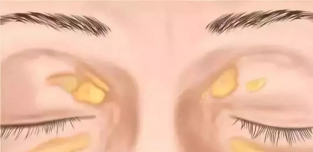 最新瓣膜,奇遇之旅揭秘瓣膜创新历程