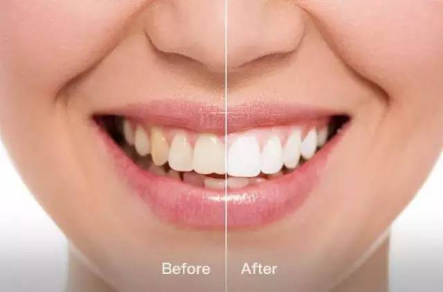 最新美牙技术引领牙齿美容革新潮流